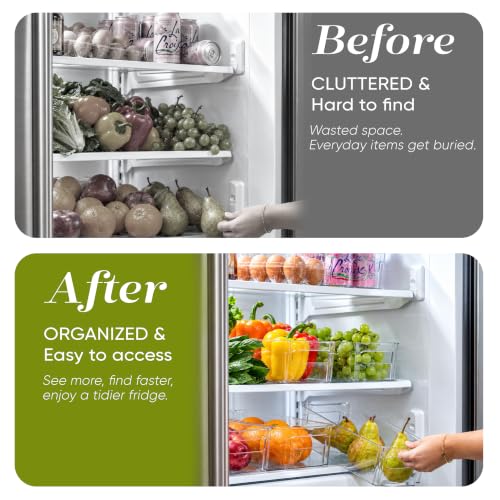 Oizeir 8 Pack Clear Plastic Storage Bins with Handles - Stackable BPA-Free - size: 8-Pack with Handles